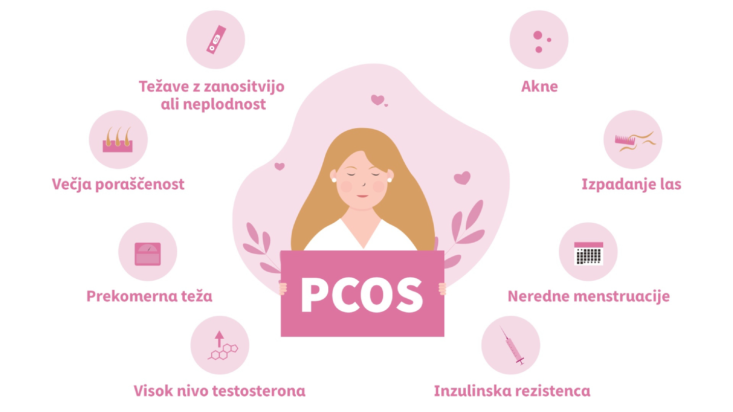 Infografika možnih simptomov PCOS.